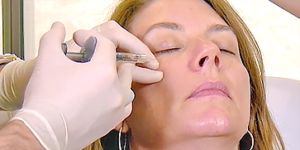 Neurotoxin & Filler Bundle